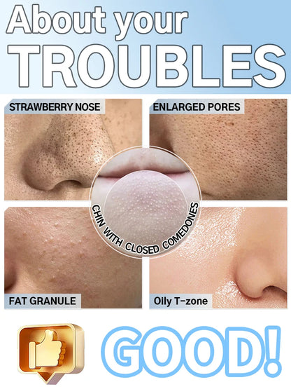 Electric Pore Cleanser