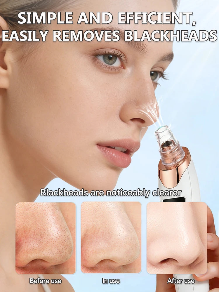 Electric Pore Cleanser